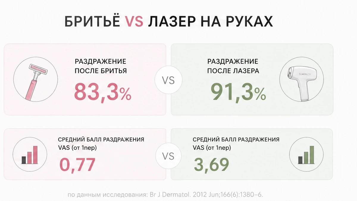Инфографика: раздражение после бритья рук против лазерного курса — цифры 83,3% и 91,3%
